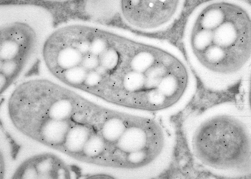 Black and white image of plant cells infected with symbiotic bacteria, which appear as black dots.