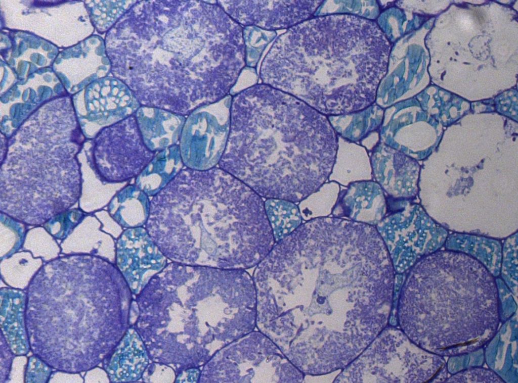 A photo taken through a microscope shows the cross section of root nodules and the bacteria inside. There are large purple circles and smaller blue circles.